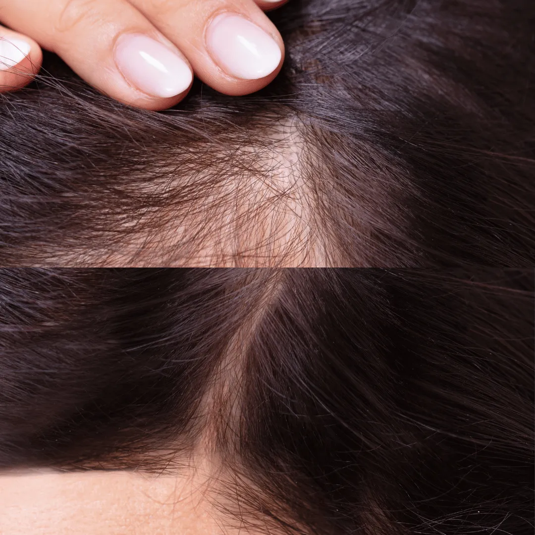 Before-After-Images-Real-Client-Transformations-Healthy-Beginnings-Wellness-Esthetics-201